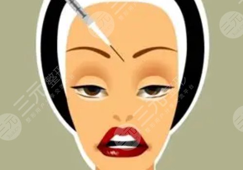 瑞藍玻尿酸打在哪個部位？