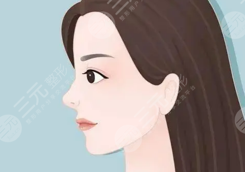 墊鼻基底前后對比照