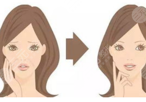 黑金dpl超光子嫩膚和m22區(qū)別