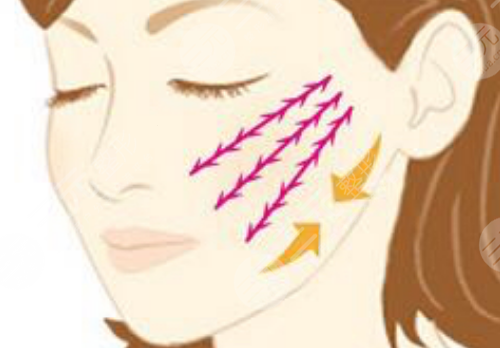 黑金dpl超光子嫩膚和m22區(qū)別