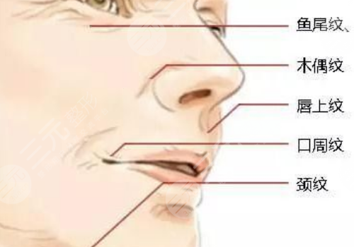 黑金dpl超光子嫩膚和m22區(qū)別