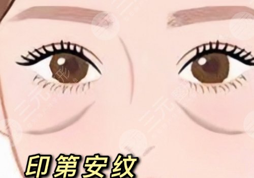 印第安紋和淚溝的區(qū)別是什么？