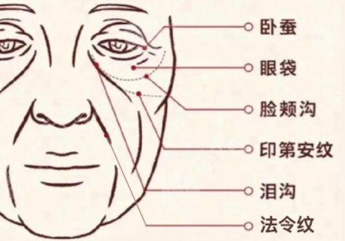印第安紋和淚溝的區(qū)別是什么？