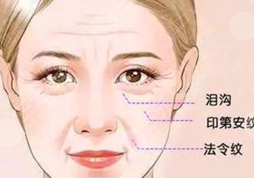 印第安紋和淚溝的區(qū)別是什么？