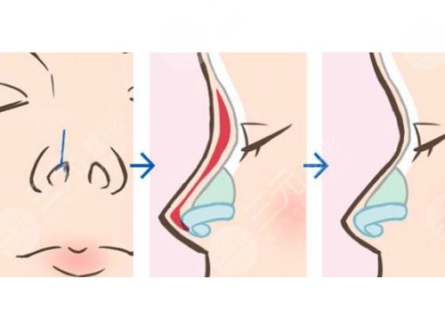 海南韓美醫(yī)學(xué)美容醫(yī)院怎么樣？