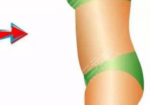 腰腹環(huán)吸大概多少錢