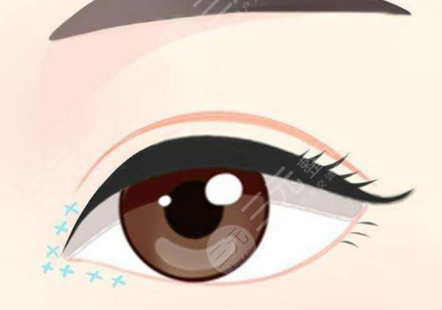 青海潤(rùn)美整形美容醫(yī)院是正規(guī)的嗎