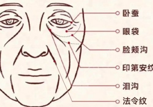 印第安紋填充膠原蛋白和玻尿酸哪個(gè)好？