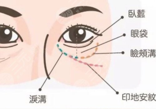 印第安紋填充膠原蛋白和玻尿酸哪個(gè)好？