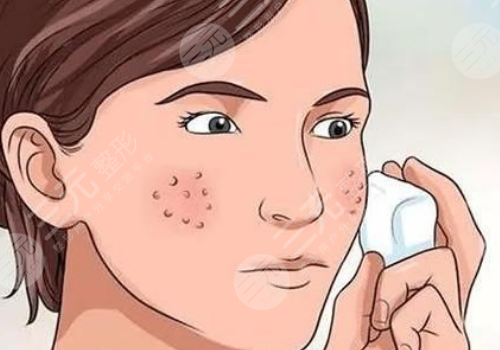 面頰毛孔粗大怎么辦？