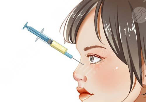 濡白天使隆鼻維持多久？