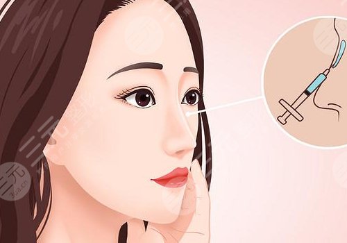 濡白天使隆鼻維持多久？