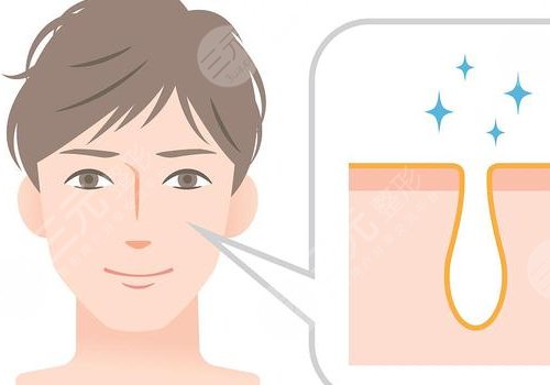 t區(qū)反復(fù)長痘痘的原因是什么？