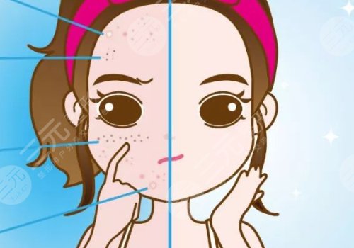 t區(qū)反復(fù)長痘痘的原因是什么？