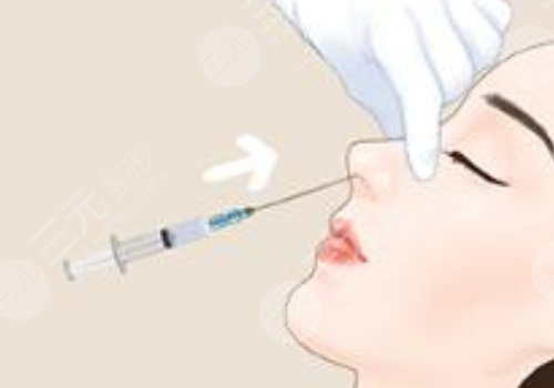 寶尼達隆鼻可以維持多久？