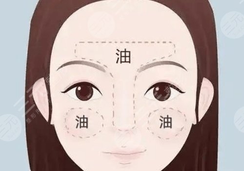 t區(qū)出油毛孔粗大什么原因？