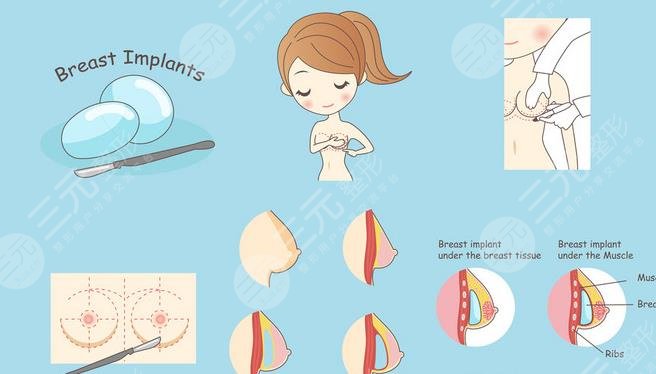 胸型有哪幾種分類？