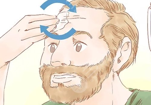 抬頭紋去除手術(shù)需要多少錢？