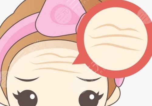 抬頭紋去除手術(shù)需要多少錢？