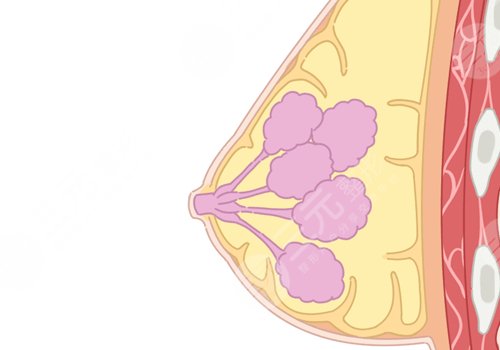 哪種胸型更好看？