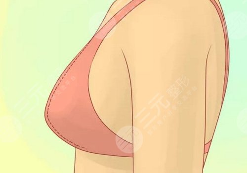 哪種胸型更好看？