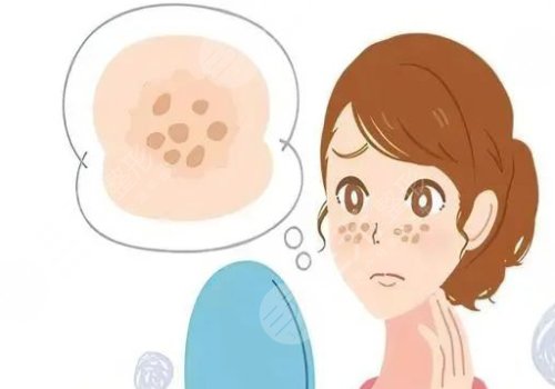 臉頰兩側(cè)長斑是什么原因？