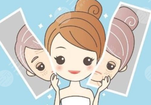 臉頰兩側(cè)長斑是什么原因？