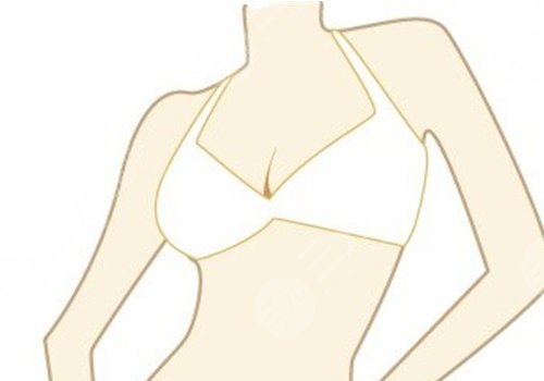 胸型不好看可以調整嗎？