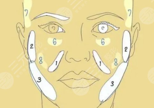 顴弓吸脂有什么后遺癥？