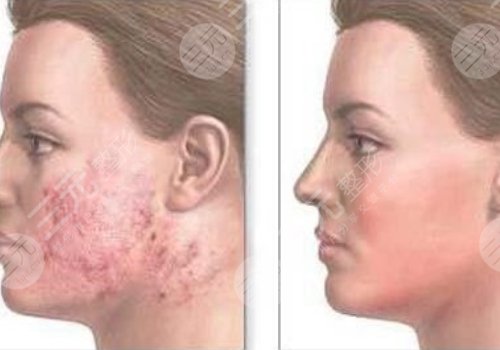 南華大學(xué)附屬第一醫(yī)院整形外科是外包嗎？