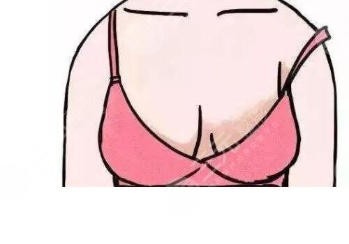 胸型大小不一樣怎么辦