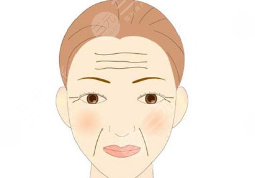 抬頭紋怎么去除？