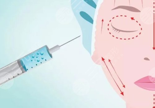 外輪廓固定提升有哪些手術(shù)方案？