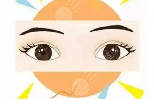 孫培靈醫(yī)生雙眼皮修復(fù)怎么樣？