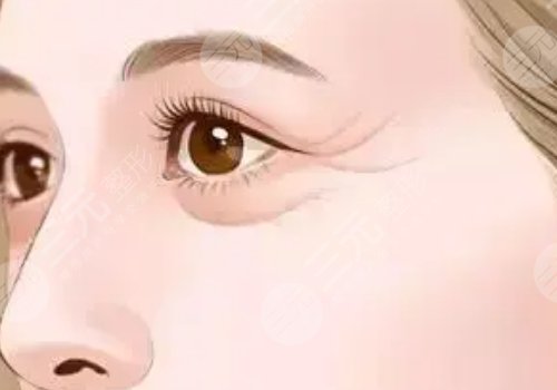 薇旖美可以注射眼部周圍的皺紋不？