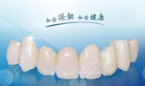 烤瓷牙多少錢一顆價(jià)格表2023查詢！牙齒修復(fù)必備~