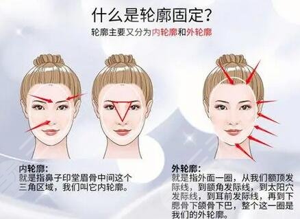 臉部輪廓固定能維持多久？