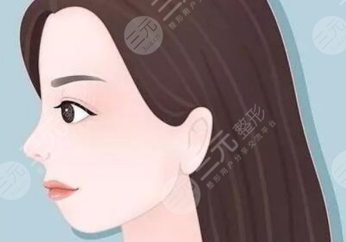 下巴后縮可以矯正過(guò)來(lái)嗎？