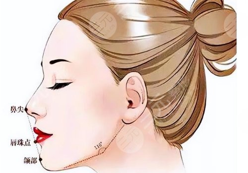 下巴后縮可以矯正過(guò)來(lái)嗎？