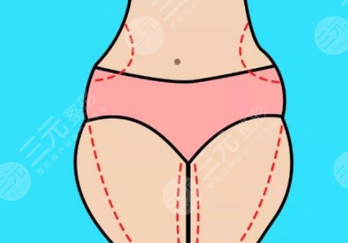 腰腹部抽脂對(duì)身體有什么傷害