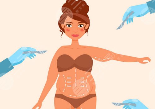 腰腹部抽脂對(duì)身體有什么傷害