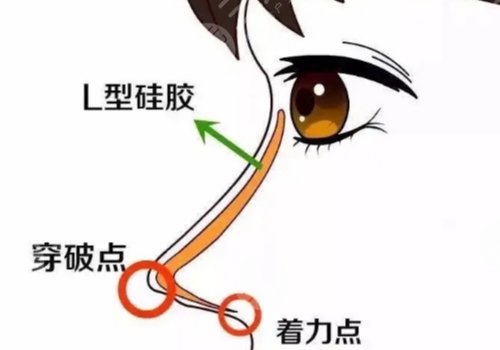 杭州隆鼻專家前十名排名