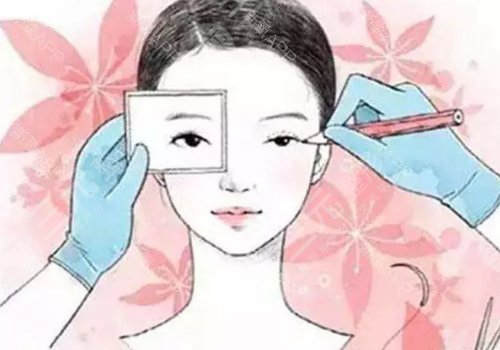 浙大一院哪個醫(yī)生割雙眼皮好