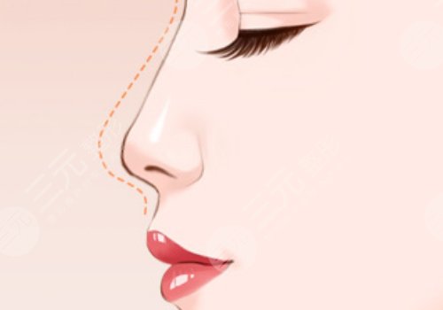 翹鼻和直鼻哪個好看？