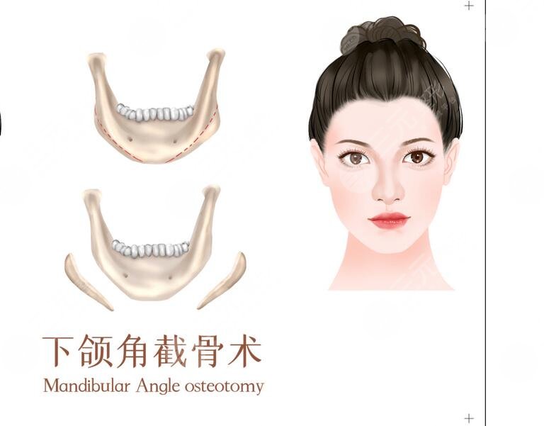 上海第九人民醫(yī)院整形科擅長項(xiàng)目科普