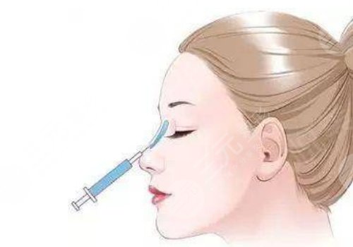 廣州顏玲做鼻子如何？