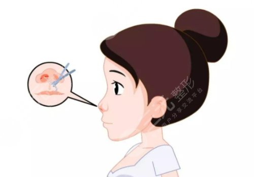 杭州藝星鼻修復(fù)醫(yī)生