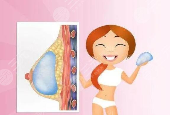 德美假體可以終身不取嗎？放在身體一輩子會怎么樣？乳腺專家回答