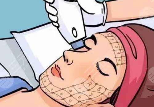 光電抗衰有沒有副作用