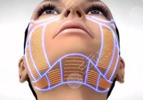 光電抗衰有沒有副作用